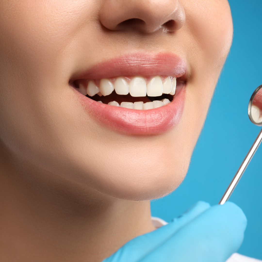 Crown Lengthening image